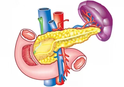 Diagnosis of pancreatic cancer1