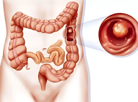 Genetically engineered drugs1