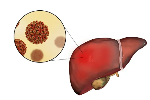 Liver cancer symptoms1
