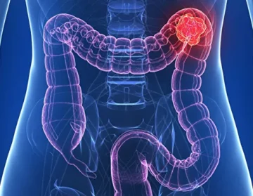 Signs of breast cancer and diagnostic methods1 (1)