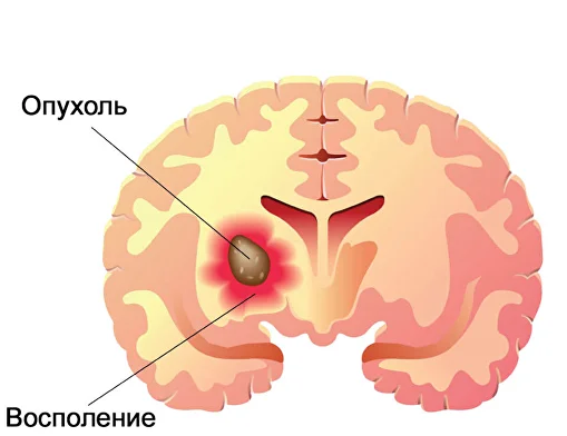 brain img1
