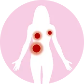 乳腺肿瘤直径2.8 cm，腋窝区域肿瘤直径1.3 cm；肝脏病灶直径最大达3 cm