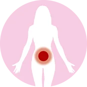 宫颈肿瘤大小为79×55 mm，伴随邻近淋巴结肿大